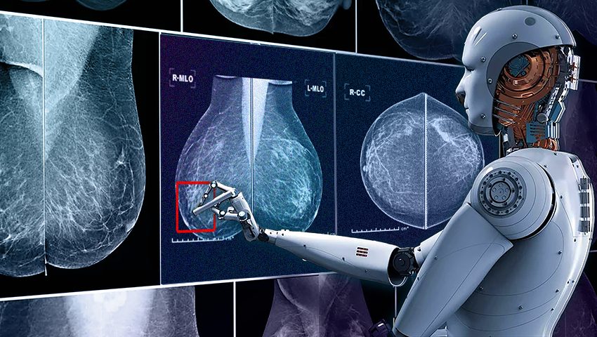 How Artificial Intelligence Can Improve the Next Generation of Breast Cancer Detection in the NHS